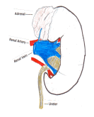 Figure 1 Kidney Cancer