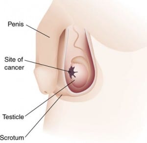 image showing the location of testicular cancer